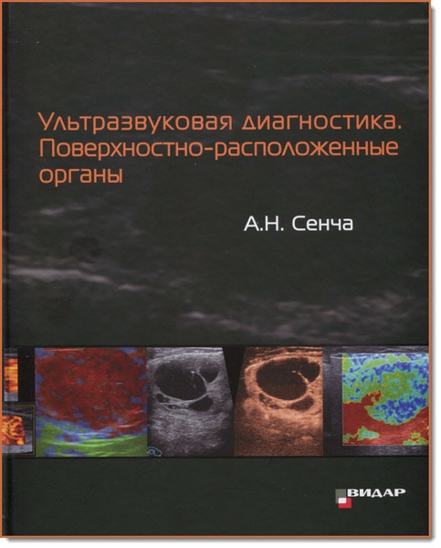 Ультразвуковая диагностика. Поверхностно-расположенные органы